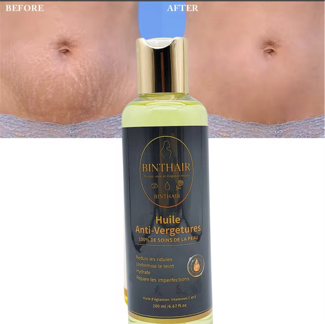 🌿 Huile Anti-Vergetures BINTHAIR – Soin réparateur 100% naturel