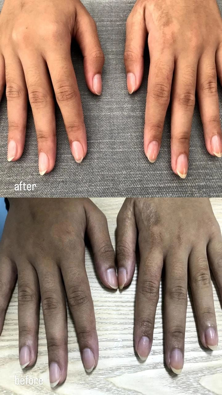 🌟 Huile Top Chrono  anti taches – By Binthair 100ml