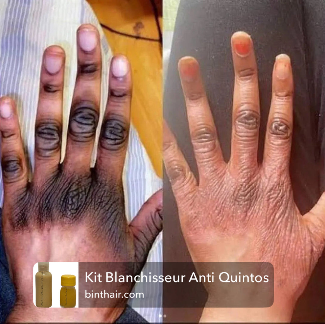 Kit Blanchisseur Anti Quintos