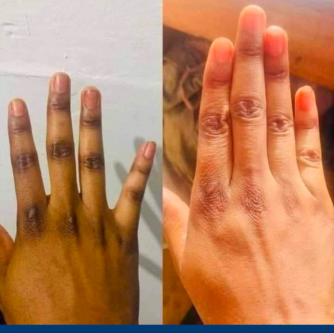 SAVON noir DU NIGERIA ULTRA BLANCHISSANT ANTI IMPERFECTION ZÉRO TACHE