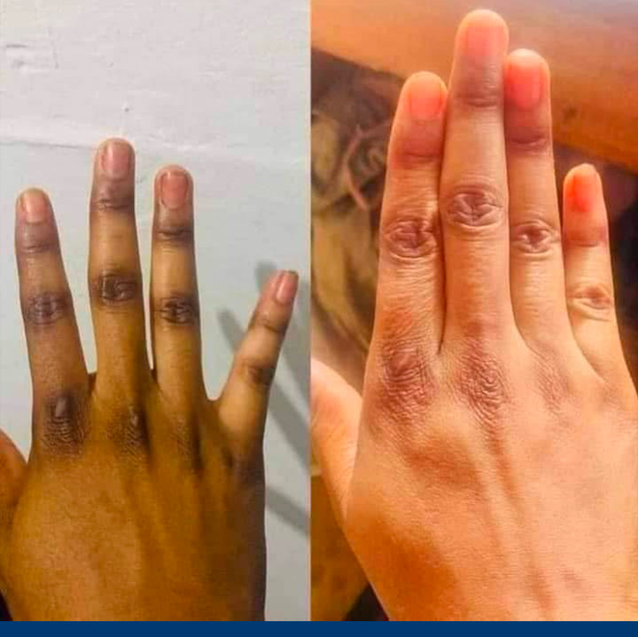 SAVON noir DU NIGERIA ULTRA BLANCHISSANT ANTI IMPERFECTION ZÉRO TACHE