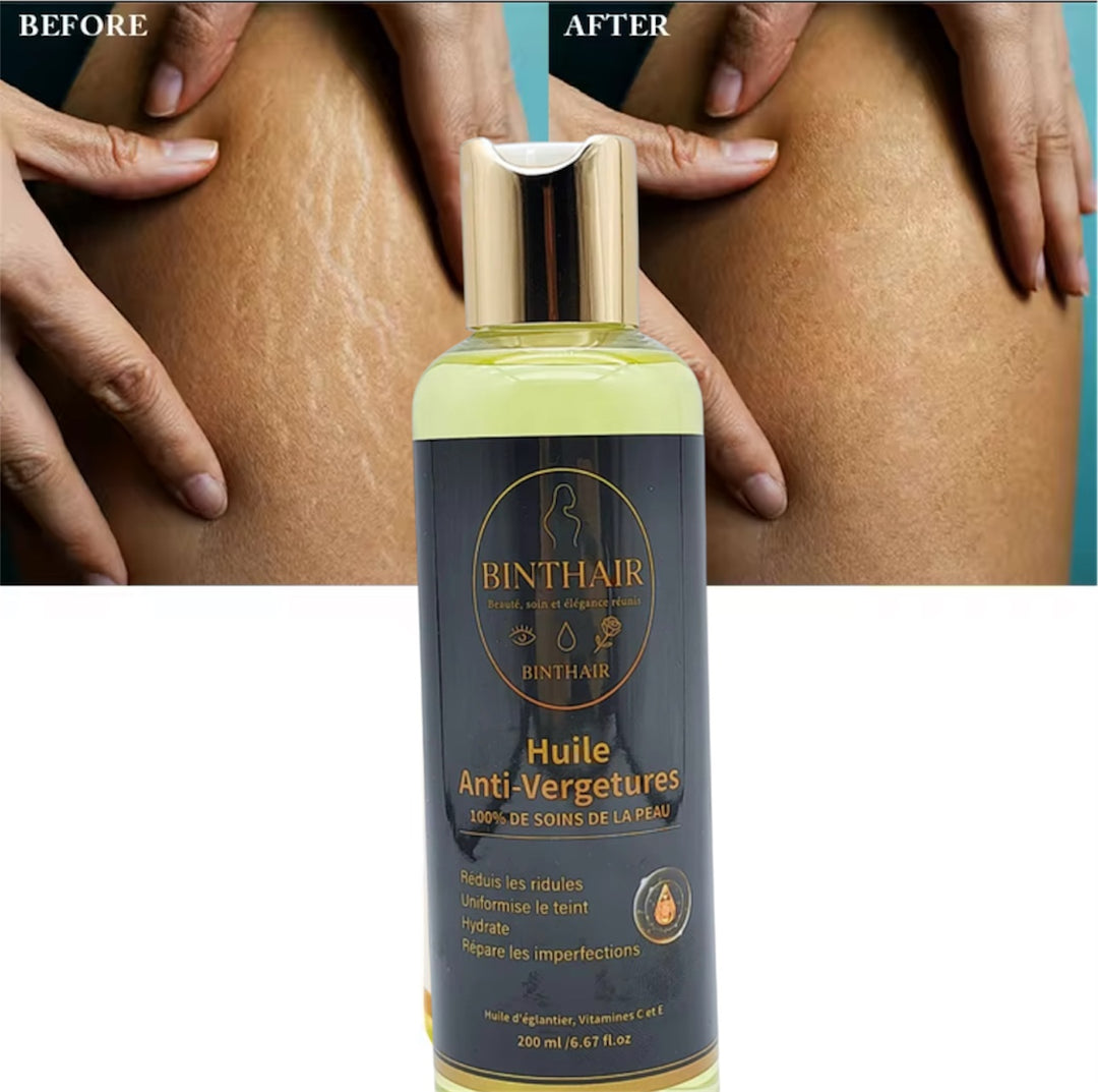 🌿 Huile Anti-Vergetures BINTHAIR – Soin réparateur 100% naturel
