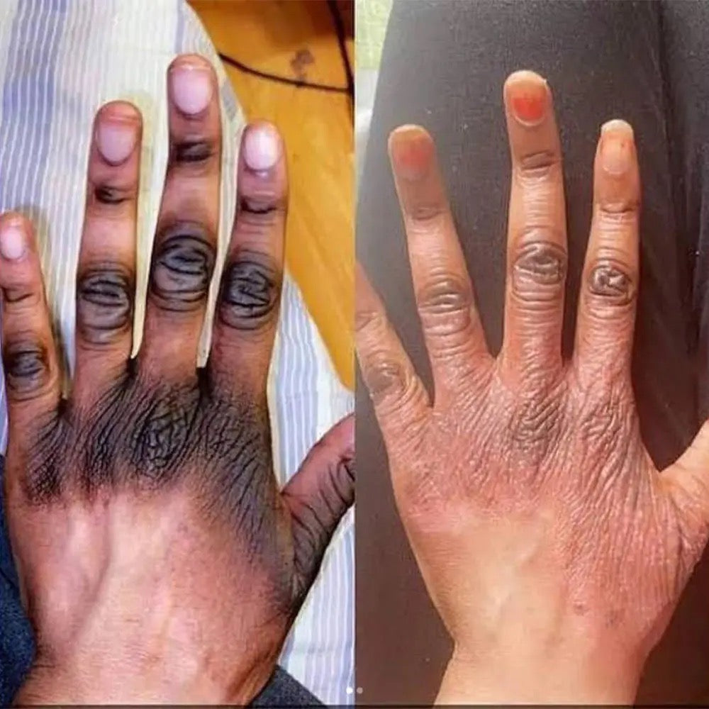 Kit Blanchisseur Anti Quintos