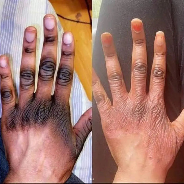 Kit Blanchisseur Anti Quintos