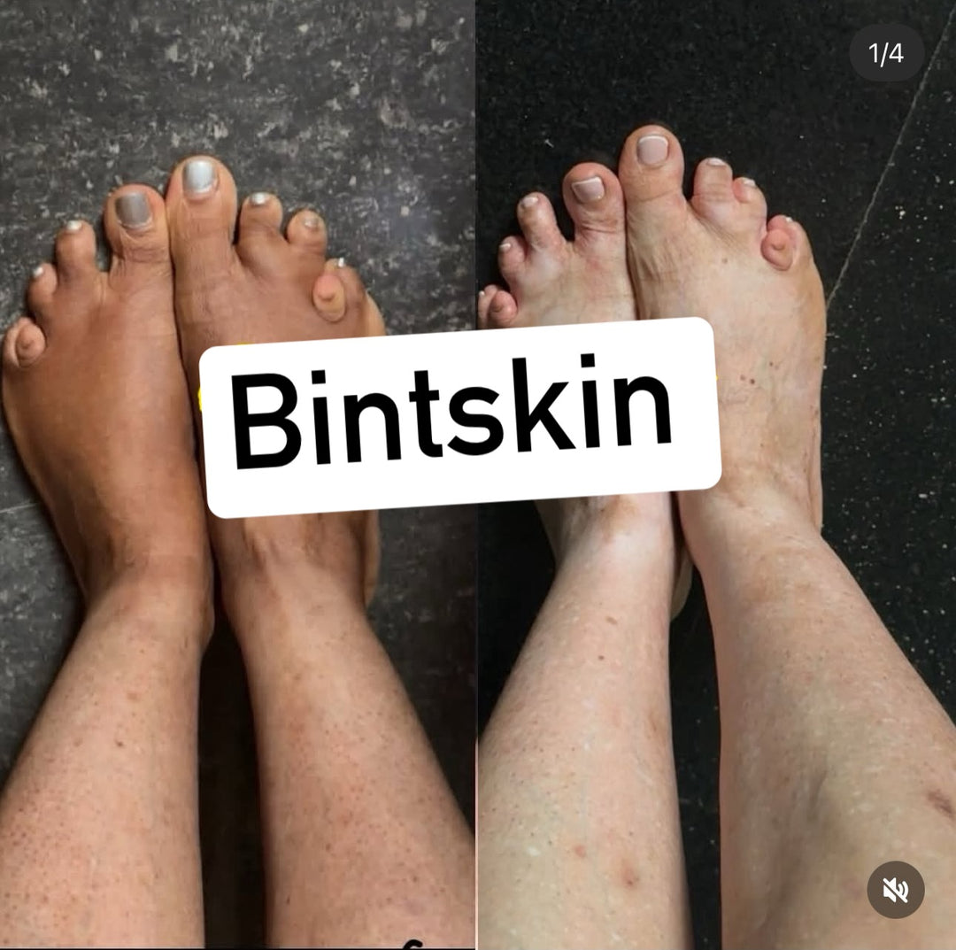 Kit Blanchisseur Anti Quintos