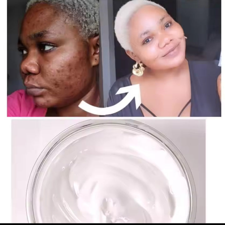 Bintskin Crème de Visage Blancheur