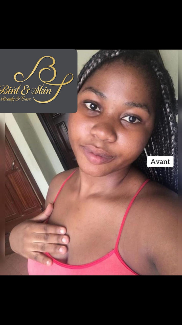 Bintskin Crème de Visage Blancheur