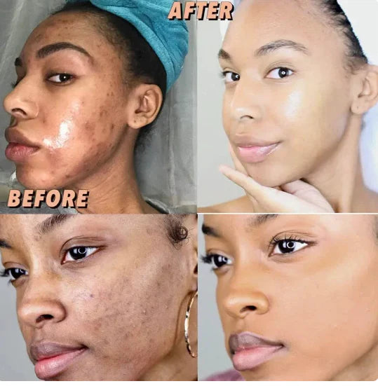 Savon overdose visage