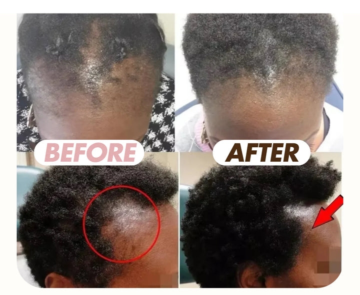 Hair Boost cheveux et barbe