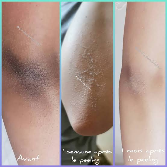 🌟 Huile Top Chrono  anti taches – By Binthair 100ml