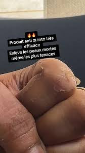 Creme Overdose de quintaux