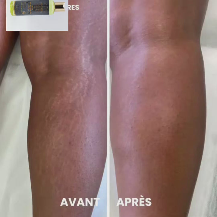 🌿 Huile Anti-Vergetures BINTHAIR – Soin réparateur 100% naturel